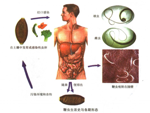 农妇突发腹痛，”凶手”从何而来？