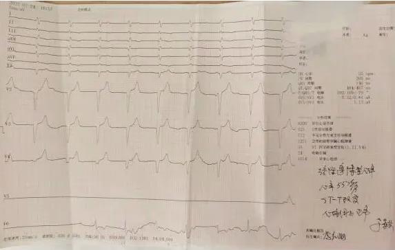 一尿毒症患者心脏骤停 红河州第三人民医院将其从死神手中抢回