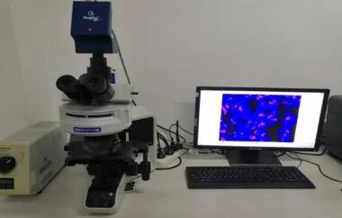 红河州第三人民医院完成100例乳腺癌HER2基因检测