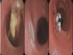 1543220743274750.jpg 4.jpg