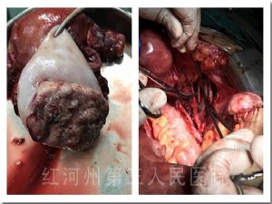 1543224166499287.jpg 1.jpg