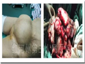 1543224175211101.jpg 2.jpg