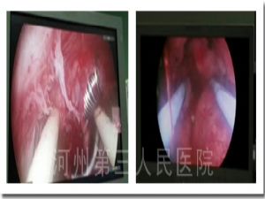 1543224184313334.jpg 3.jpg