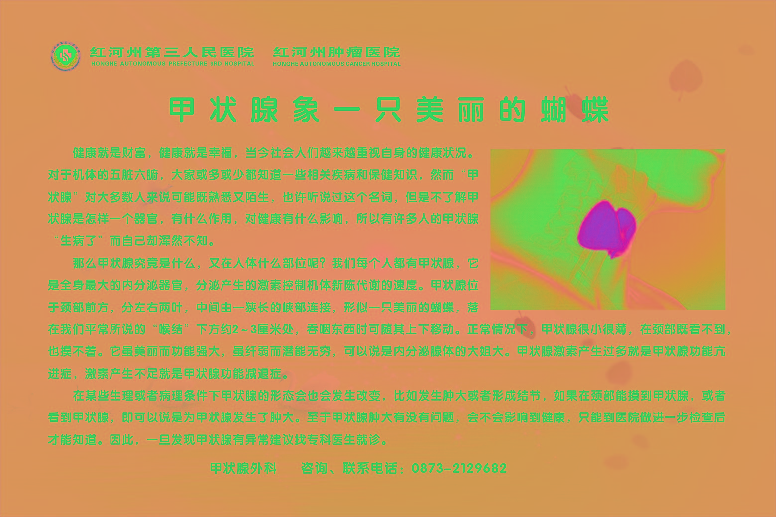 1587005776824784.jpg