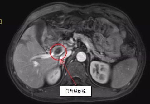 1639554526288064.png image.png