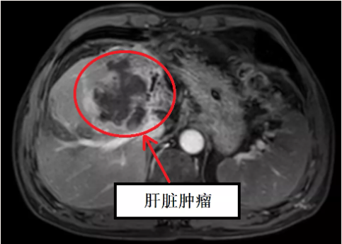 1639554541152559.png image.png