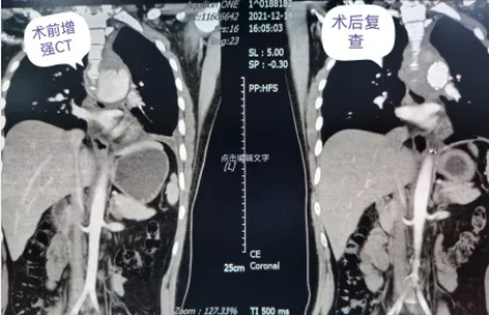 1640328101276456.png image.png