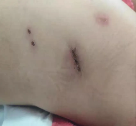 1642044172165469.png image.png