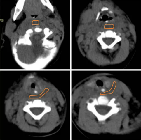 1642931532554139.png image.png