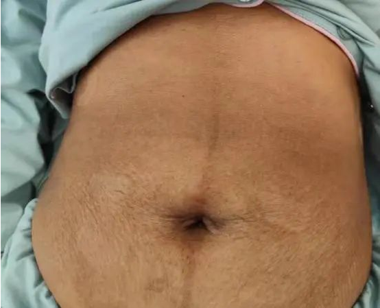 1645837945904657.png image.png