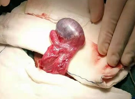 3周孩子三个睾丸图片图片