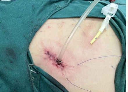 1647676241484323.png image.png