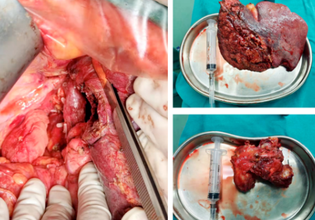 1647676564329002.png image.png