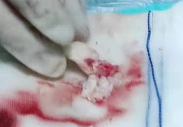 1652411106691707.png image.png