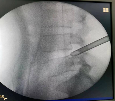 1652411126454511.png image.png