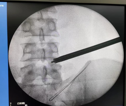 1652411133645188.png image.png