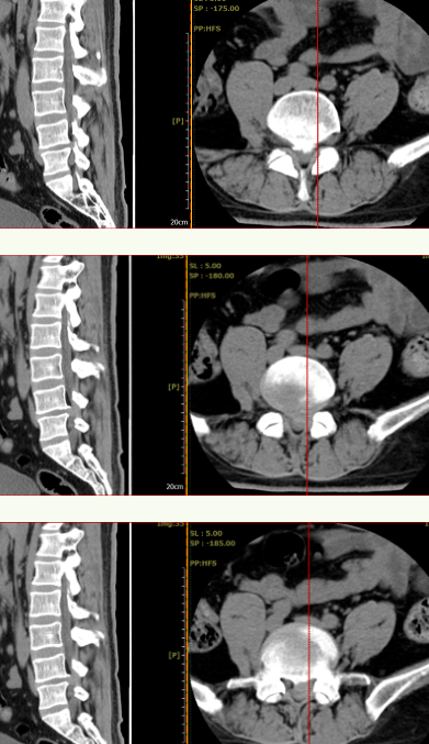 1652411184628013.png image.png