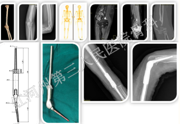 1664172903785146.png image.png