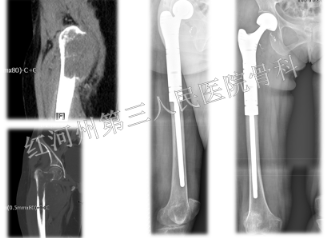 1664172921505227.png image.png