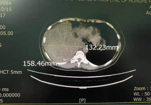 1670405983246694.jpg 0.jpg