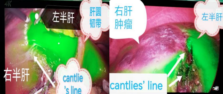 1680744920224551.jpg 1680744920224551.jpg