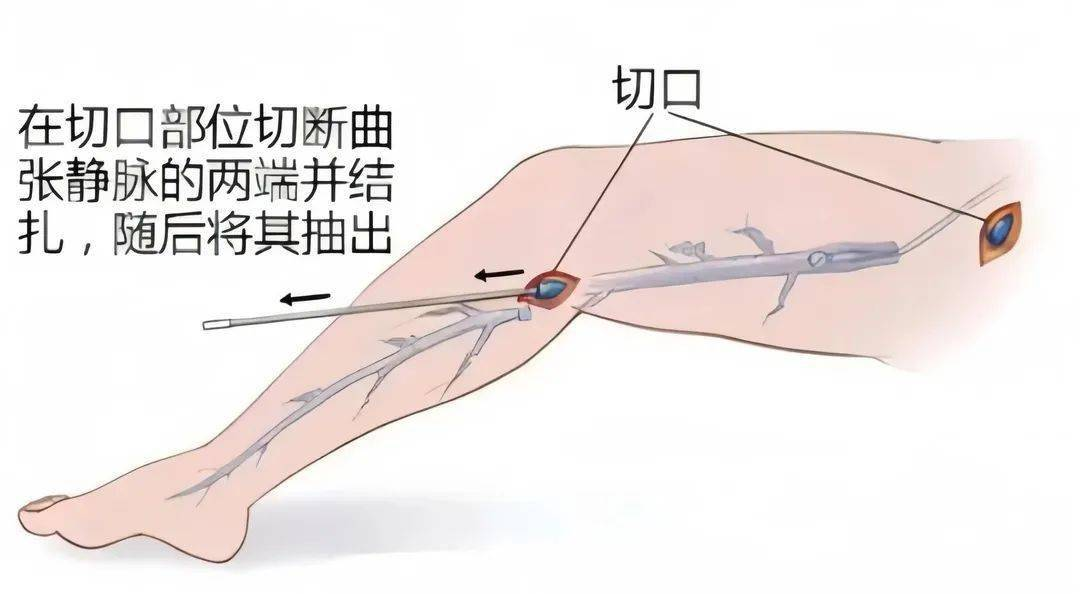 1711076145602355.png 2.png